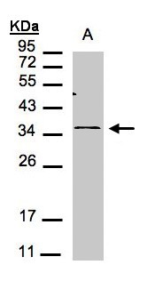 CXCR6 Antibody - Sample(30 g of whole cell lysate). A:293T. 12% SDS PAGE. CXCR6 antibody diluted at 1:1000