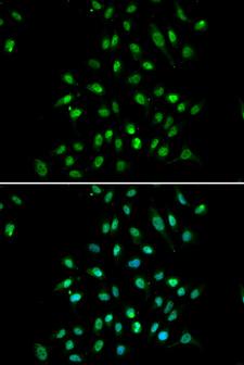 CXXC1 / CGBP Antibody - Immunofluorescence analysis of A549 cell using CXXC1 antibody. Blue: DAPI for nuclear staining.