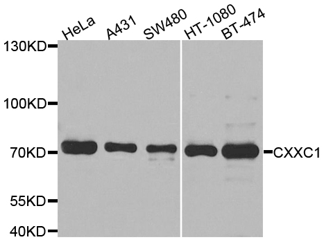 CXXC1 / CGBP Antibody - Western blot analysis of extracts of various cell lines.