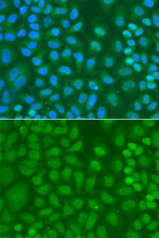 CXXC1 / CGBP Antibody - Immunofluorescence analysis of HeLa cells.