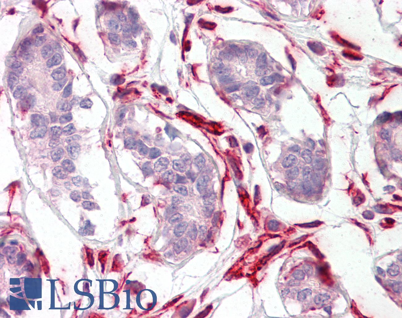 CXXC4 Antibody - Anti-CXXC4 antibody IHC of human breast. Immunohistochemistry of formalin-fixed, paraffin-embedded tissue after heat-induced antigen retrieval. Antibody dilution 3.75 ug/ml.