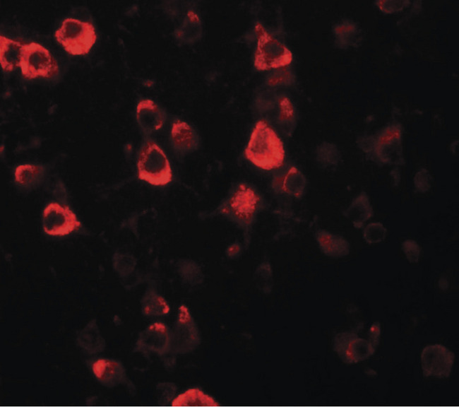 CXXC4 Antibody - Immunofluorescence of CXXC4 in human brain tissue with CXXC4 antibody at 20 ug/ml.