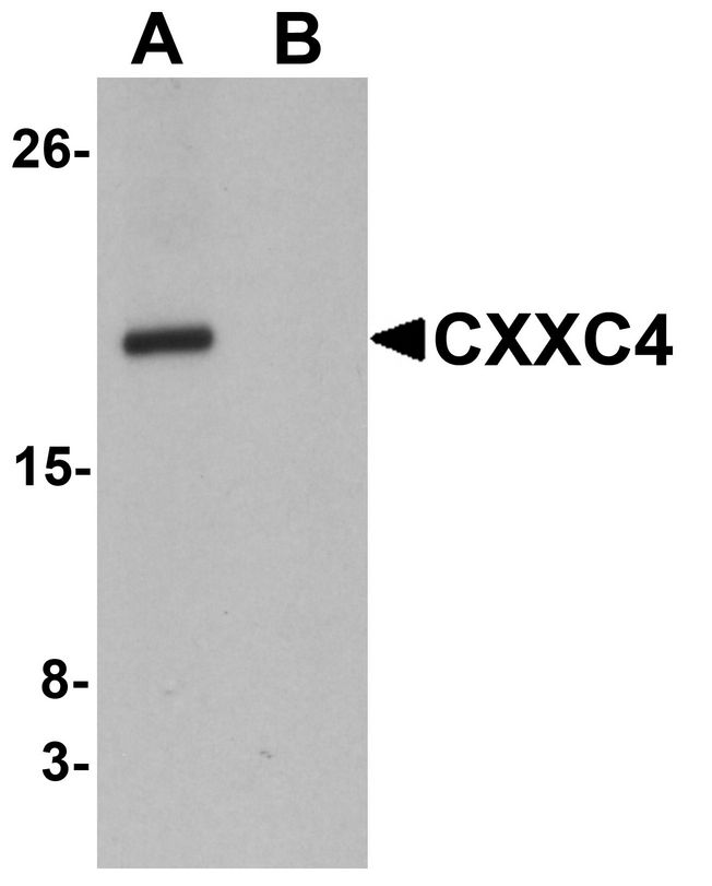 CXXC4 Antibody - Western blot analysis of CXXC4 in human brain tissue lysate with CXXC4 antibody at 1 ug/ml in (A) the absence and (B) the presence of blocking peptide.