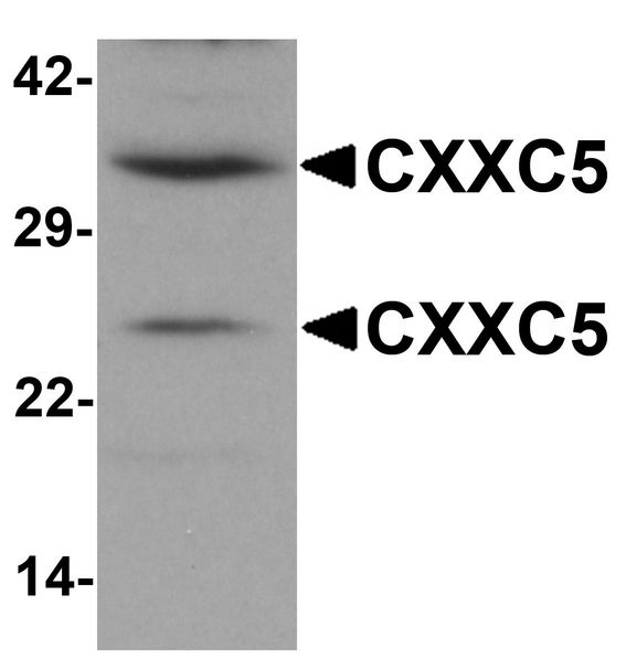 CXXC5 Antibody - Western blot analysis of CXXC5 in human brain tissue lysate with CXXC5 antibody at 1 ug/ml.