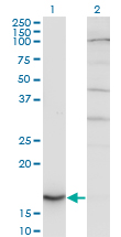 CYB5A / Cytochrome b5 Antibody - Western blot of CYB5A expression in transfected 293T cell line by CYB5A monoclonal antibody.