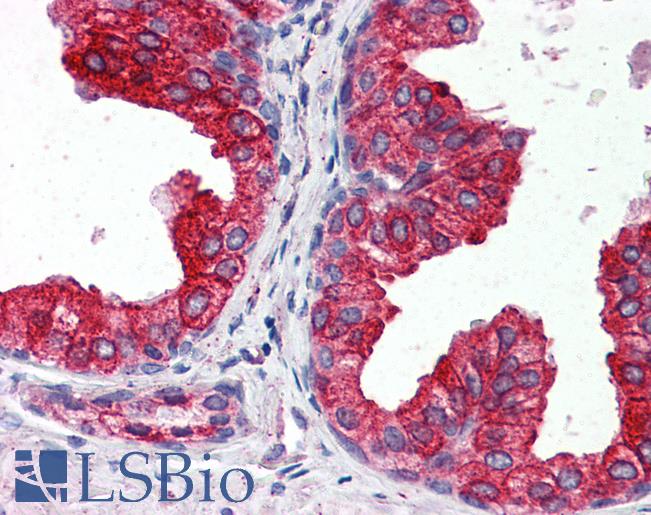 CYB5A / Cytochrome b5 Antibody - Anti-CYB5A / Cytochrome b5 antibody IHC of human prostate. Immunohistochemistry of formalin-fixed, paraffin-embedded tissue after heat-induced antigen retrieval. Antibody concentration 5 ug/ml.