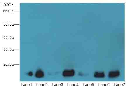 CYB5B Antibody - Western blot. All lanes: CYB5B antibody at 0.8 ug/ml. Lane 1: HepG-2 whole cell lysate. Lane 2: Mouse liver tissue. Lane 3: Mouse heart tissue. Lane 4: HeLa whole cell lysate. Lane 5: U87 whole cell lysate. Lane 6: EC109 whole cell lysate. Lane 7: A549 whole cell lysate. Secondary Goat polyclonal to Rabbit IgG at 1:10000 dilution. Predicted band size: 16 kDa. Observed band size: 16 kDa.