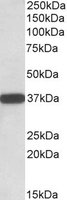 CYB5R3 / B5R Antibody - CYB5R3 antibody (0.01 ug/ml) staining of Human Umbilical Cord lysate (35 ug protein/ml in RIPA buffer). Primary incubation was 1 hour. Detected by chemiluminescence.