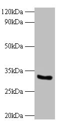 CYB5R3 / B5R Antibody - Western blot All lanes: NADH-cytochrome b5 reductase 3 antibody at 2µg/ml Lane 1: EC109 whole cell lysate Lane 2: 293T whole cell lysate Secondary Goat polyclonal to rabbit IgG at 1/10000 dilution Predicted band size: 35, 32, 39 kDa Observed band size: 32 kDa