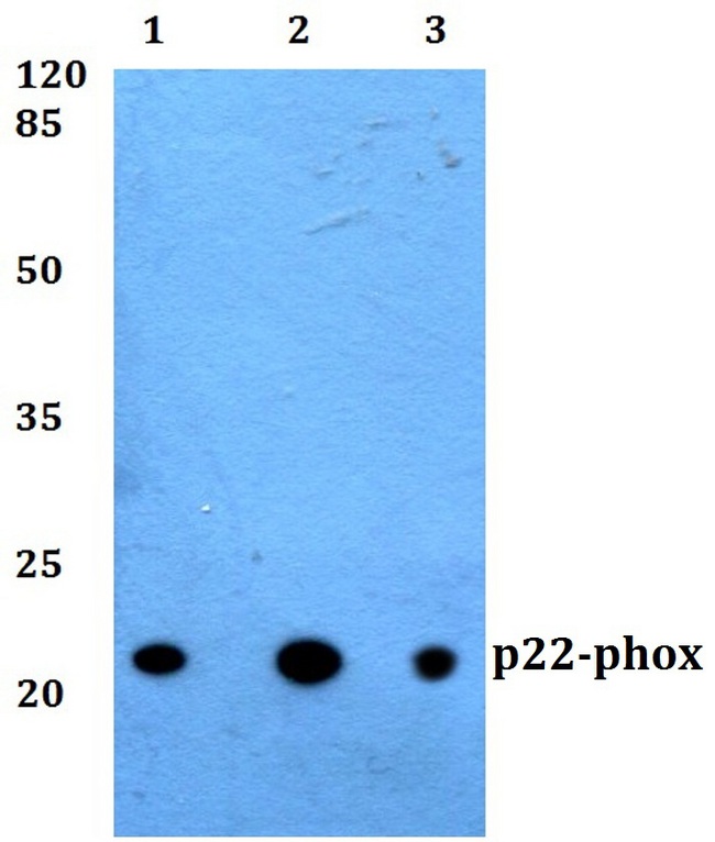 CYBA / p22phox Antibody - Western blot (WB) analysis of Anti-p22phox pAb at 1:500 dilution. Lane1:MCF-7 whole cell lysate. Lane2:NIH-3T3 whole cell lysate. Lane3:PC12 whole cell lysate.