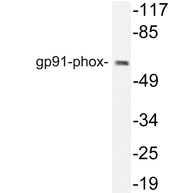 CYBB / NOX2 / gp91phox Antibody - Western blot of gp91-phox (I502) pAb in extracts from HT29 cells.