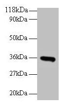 CYC1 / Cytochrome C-1 Antibody - Western blot All lanes: Cytochrome c1, heme protein, mitochondrial antibody at 2µg/ml + EC109 whole cell lysate Secondary Goat polyclonal to rabbit IgG at 1/15000 dilution Predicted band size: 36 kDa Observed band size: 36 kDa