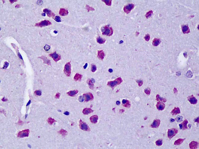 CYLD Antibody - Anti-CYLD antibody IHC of mouse brain. Immunohistochemistry of formalin-fixed, paraffin-embedded tissue after heat-induced antigen retrieval. Antibody concentration 5 ug/ml.