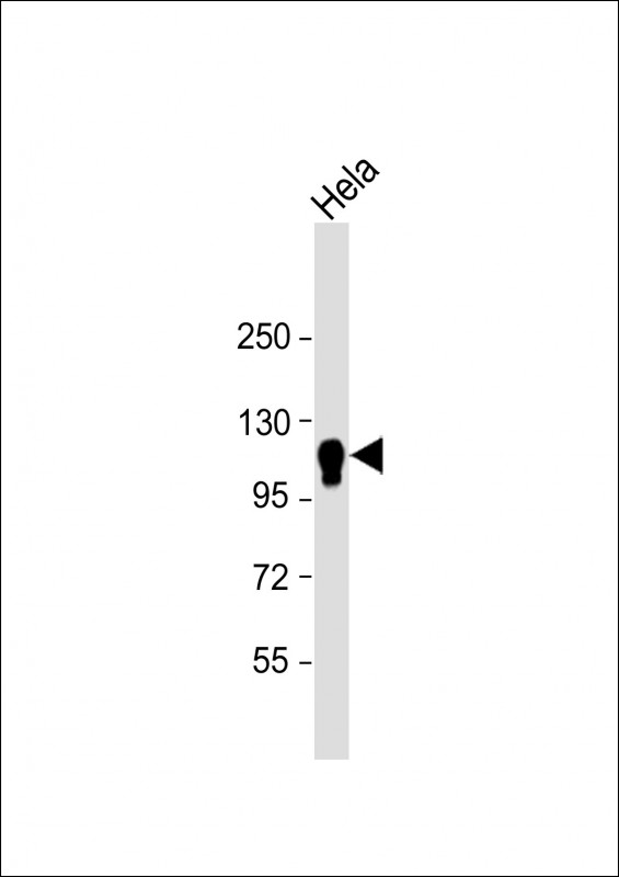 CYLD Antibody - Anti-CYLD Antibody at 1:4000 dilution + Hela whole cell lysate Lysates/proteins at 20 µg per lane. Secondary Goat Anti-mouse IgG, (H+L), Peroxidase conjugated at 1/10000 dilution. Predicted band size: 107 kDa Blocking/Dilution buffer: 5% NFDM/TBST.
