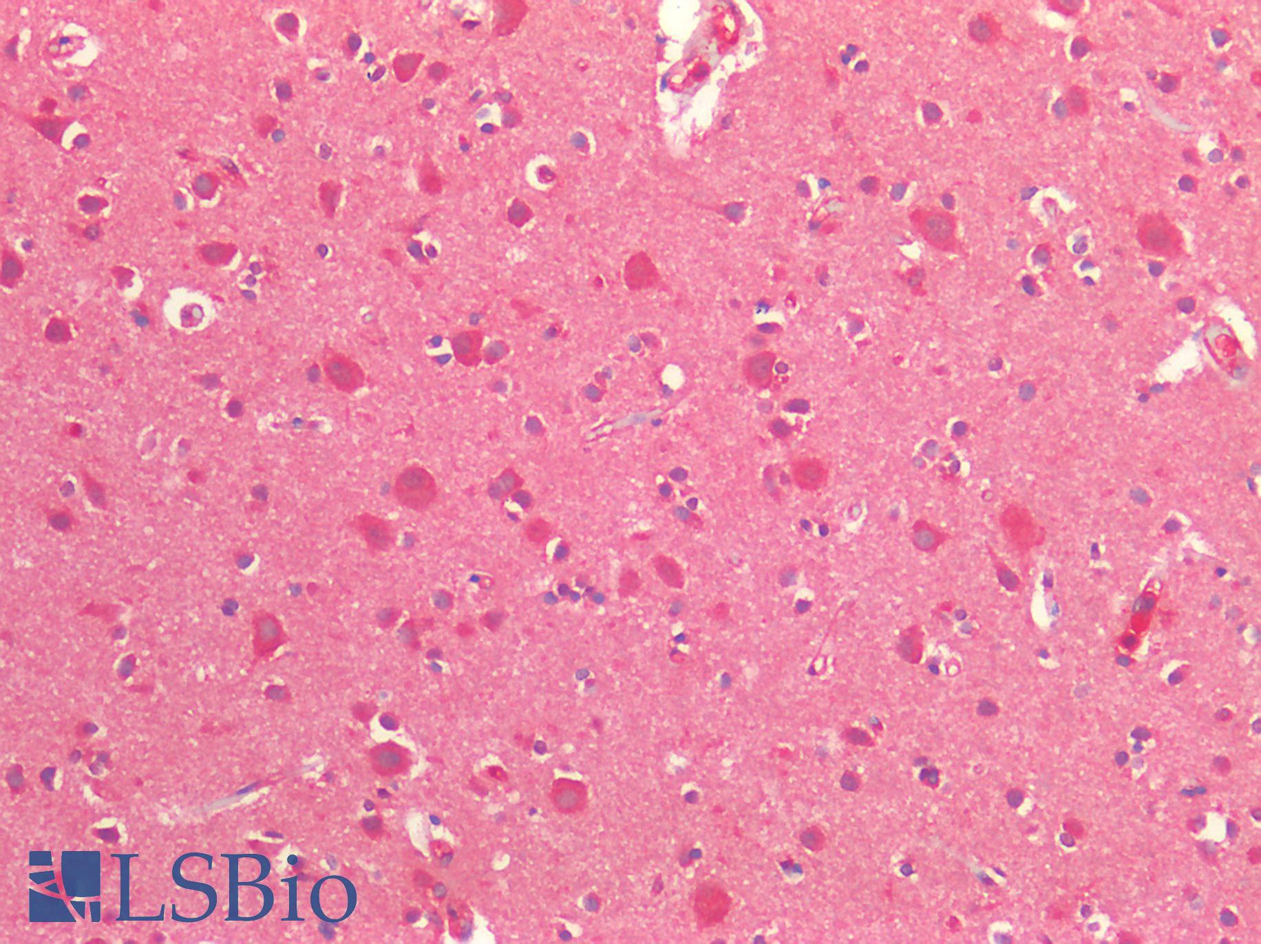 CYLD Antibody - Human Brain, Cortex: Formalin-Fixed, Paraffin-Embedded (FFPE)