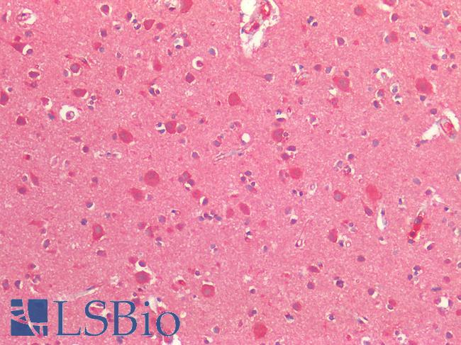 CYLD Antibody - Human Brain, Cortex: Formalin-Fixed, Paraffin-Embedded (FFPE)