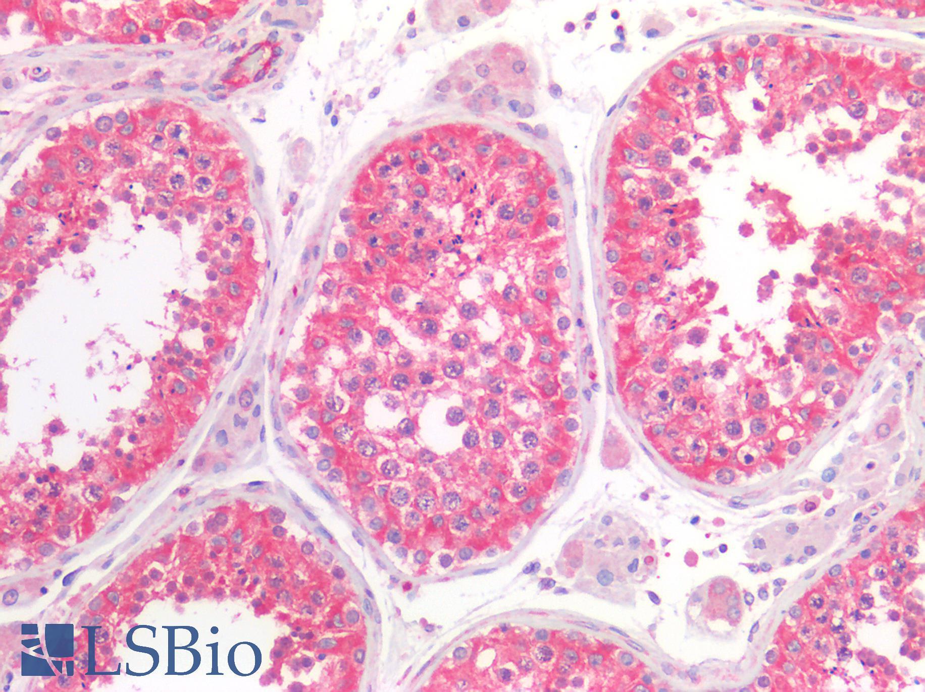 CYLD Antibody - Human Testis: Formalin-Fixed, Paraffin-Embedded (FFPE)