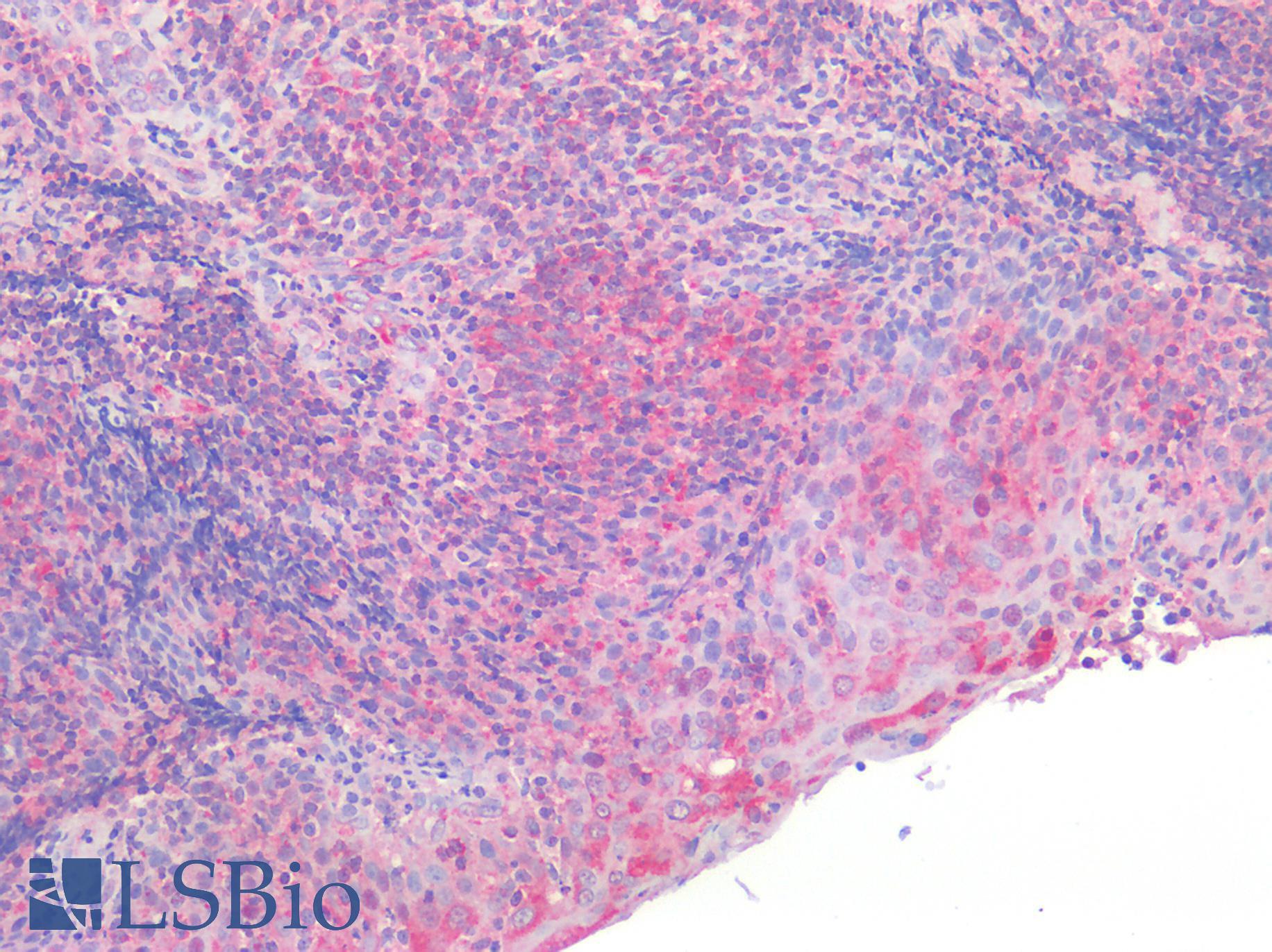 CYLD Antibody - Human Tonsil: Formalin-Fixed, Paraffin-Embedded (FFPE)