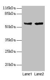 CYP17 / CYP17A1 Antibody - Western blot All lanes: Steroid 17-alpha-hydroxylase/17, 20 lyase antibody at 2µg/ml Lane 1: Hela whole cell lysate Lane 2: A549 whole cell lysate Secondary Goat polyclonal to rabbit IgG at 1/10000 dilution Predicted band size: 57 kDa Observed band size: 57 kDa