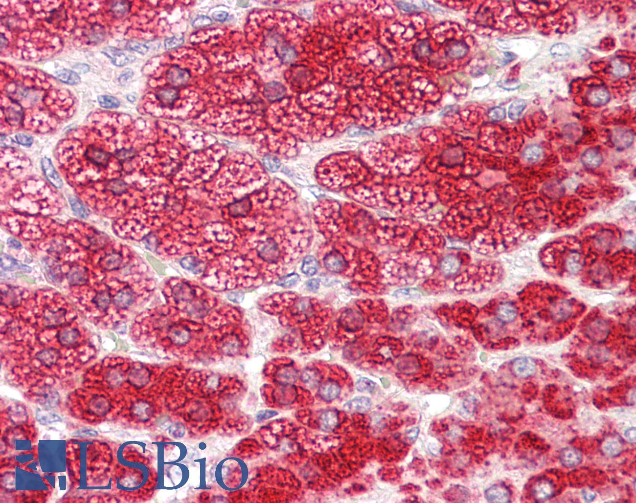 CYP17 / CYP17A1 Antibody - Anti-CYP17 / CYP17A1 antibody IHC of human adrenal. Immunohistochemistry of formalin-fixed, paraffin-embedded tissue after heat-induced antigen retrieval. Antibody dilution 3.75 ug/ml.