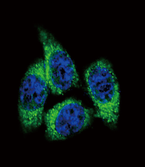 CYP17 / CYP17A1 Antibody - Confocal immunofluorescence of CYP17A1 Antibody with HeLa cell followed by Alexa Fluor 488-conjugated goat anti-rabbit lgG (green). DAPI was used to stain the cell nuclear (blue).