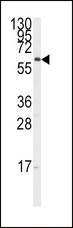 CYP17 / CYP17A1 Antibody - Western blot of anti-CYP17A1 Antibody in K562 cell line lysates (35 ug/lane). CYP17A1(arrow) was detected using the purified antibody.