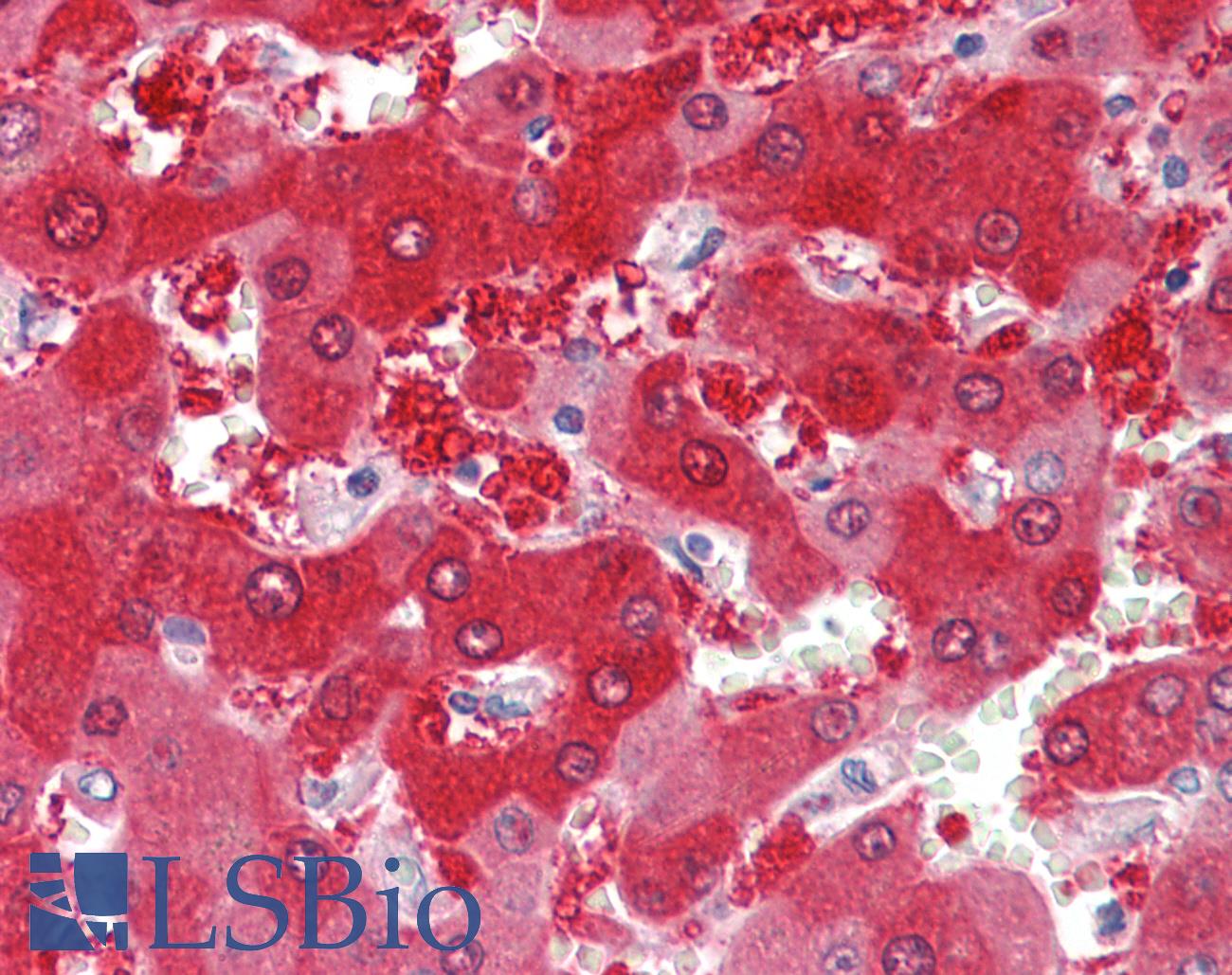 CYP1A1 Antibody - Anti-CYP1A1 antibody IHC staining of human liver. Immunohistochemistry of formalin-fixed, paraffin-embedded tissue after heat-induced antigen retrieval.