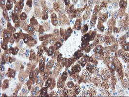 CYP1A2 Antibody - IHC of paraffin-embedded Human liver tissue using anti-CYP1A2 mouse monoclonal antibody.