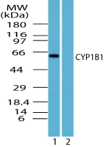 CYP1B1 Antibody - Western blot of human CYP1B1 in human brain lysate in the 1) absence and 2) presence of immunizing peptide using antibody at 1 ug/ml.