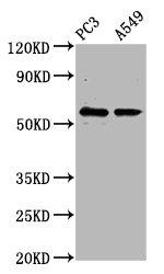 CYP1B1 Antibody - Western Blot Positive WB detected in: PC3 whole cell lysate, A549 whole cell lysate All Lanes: CYP1B1 antibody at 6.62µg/ml Secondary Goat polyclonal to rabbit IgG at 1/50000 dilution Predicted band size: 61 KDa Observed band size: 61 KDa