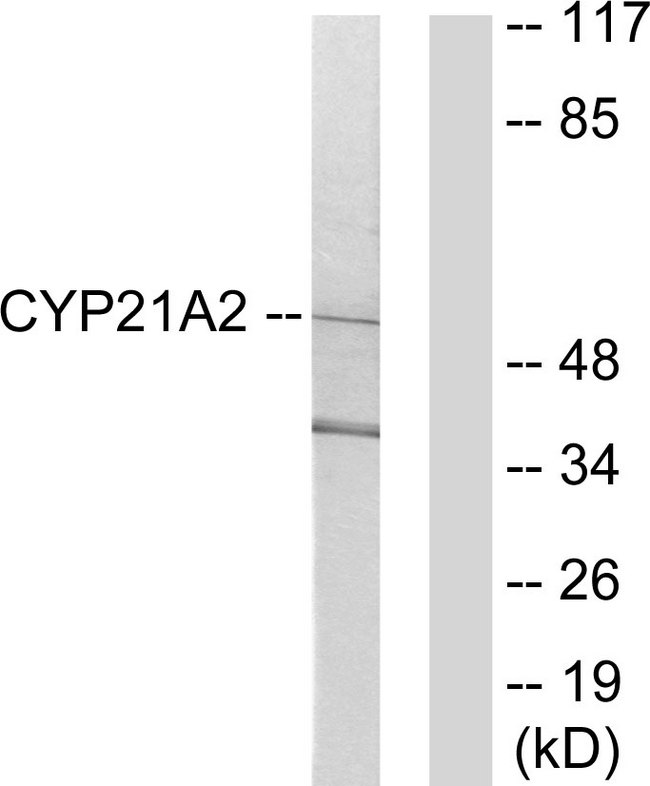 CYP21A2 Antibody - Western blot analysis of lysates from 293 cells, using Cytochrome P450 21A2 Antibody. The lane on the right is blocked with the synthesized peptide.