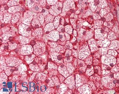CYP21A2 Antibody - Human Adrenal: Formalin-Fixed, Paraffin-Embedded (FFPE)