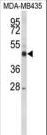 CYP21A2 Antibody - Western blot of CYP21A2 Antibody in MDA-MB435 cell line lysates (35 ug/lane). CYP21A2 (arrow) was detected using the purified antibody.