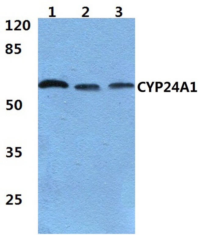CYP24 / CYP24A1 Antibody - Western blot (WB) analysis of Anti-CYP24A1 pAb at 1:500 dilution. Lane1:MCF-7 cell lysate. Lane2:sp2/0 cell lysate. Lane3:H9C2 cell lysate.