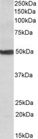 CYP24 / CYP24A1 Antibody - CYP24A1 antibody (0.1 ug/ml) staining of Human Liver lysate (35 ug protein/ml in RIPA buffer). Primary incubation was 1 hour. Detected by chemiluminescence.