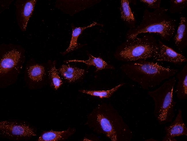 CYP26 / CYP26A1 Antibody - CYP26 / CYP26A1 antibody (2.5µg/ml) staining of PFA-fixed and TX100-treated HeLa cells after primary labelling overnight at 4C with DAPI nuclear counterstaining in blue.