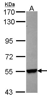 CYP26B1 Antibody - Sample (30 ug of whole cell lysate). A: Hep G2. 7.5% SDS PAGE. CYP26B1 antibody diluted at 1:1000. 