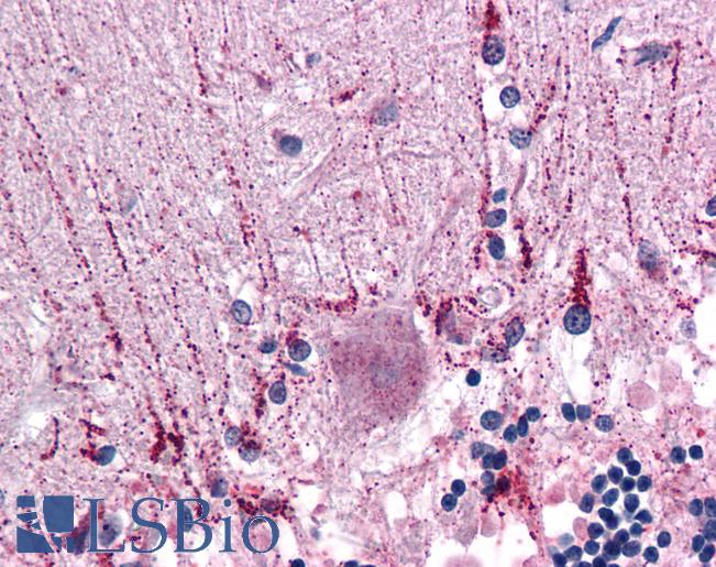 CYP26B1 Antibody - Anti-CYP26B1 antibody IHC of human brain, cerebellum. Immunohistochemistry of formalin-fixed, paraffin-embedded tissue after heat-induced antigen retrieval. Antibody concentration 10 ug/ml.
