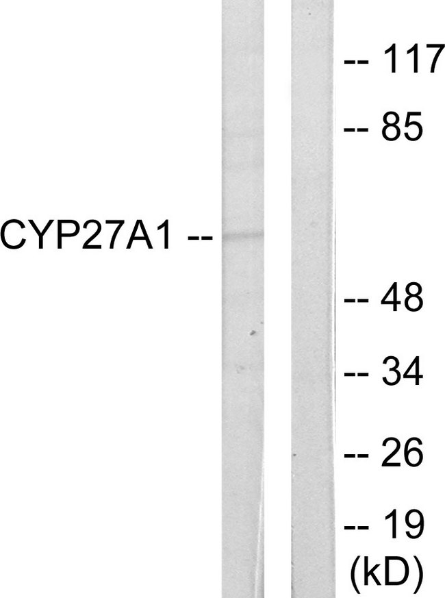 CYP27 / CYP27A1 Antibody - Western blot analysis of lysates from HeLa cells, using Cytochrome P450 27A1 Antibody. The lane on the right is blocked with the synthesized peptide.