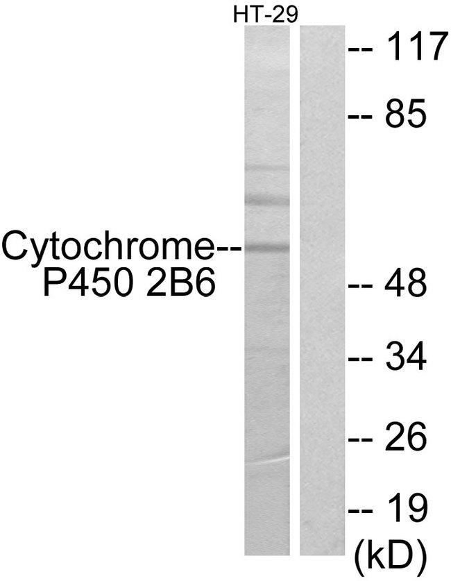 CYP2B6 Antibody - Western blot analysis of lysates from HT-29 cells, using Cytochrome P450 2B6 Antibody. The lane on the right is blocked with the synthesized peptide.