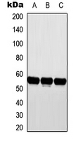 CYP2D6 Antibody - Western blot analysis of Cytochrome P450 2D6 expression in MCF7 (A); NIH3T3 (B); H9C2 (C) whole cell lysates.
