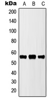 CYP2D6 Antibody - Western blot analysis of Cytochrome P450 2D6 expression in MCF7 (A); NIH3T3 (B); H9C2 (C) whole cell lysates.