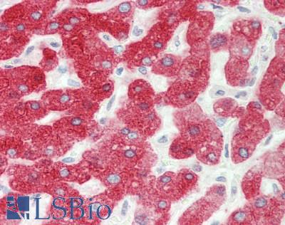 CYP2E1 Antibody - Human Liver: Formalin-Fixed, Paraffin-Embedded (FFPE)