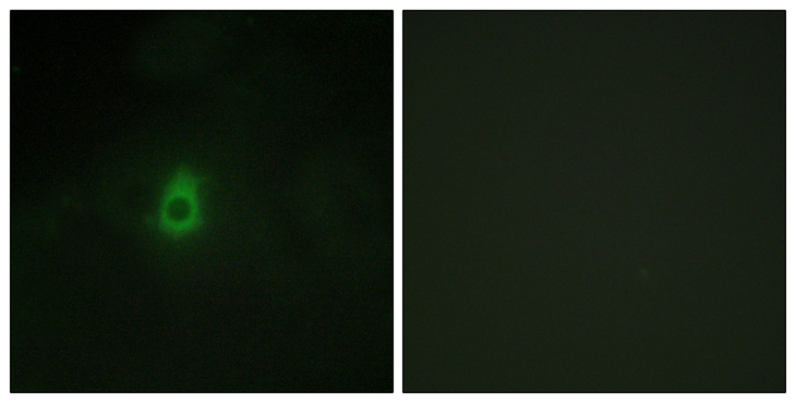 CYP2E1 Antibody - Immunofluorescence analysis of HepG2 cells, using Cytochrome P450 2E1 Antibody. The picture on the right is blocked with the synthesized peptide.