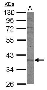 CYP2F / CYP2F1 Antibody - Sample (30 ug of whole cell lysate) A: A549 10% SDS PAGE CYP2F1 antibody diluted at 1:1000