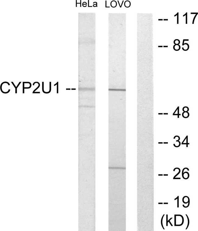 CYP2U1 Antibody - Western blot analysis of lysates from HeLa and Lovo cells, using Cytochrome P450 2U1 Antibody. The lane on the right is blocked with the synthesized peptide.