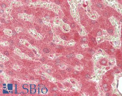 CYP39A1 Antibody - Human Liver: Formalin-Fixed, Paraffin-Embedded (FFPE)