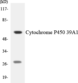 CYP39A1 Antibody - Western blot analysis of the lysates from HeLa cells using Cytochrome P450 39A1 antibody.