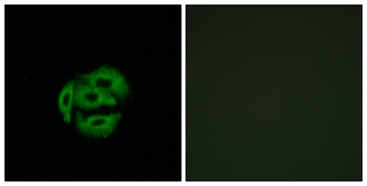 CYP39A1 Antibody - Immunofluorescence analysis of A549 cells, using Cytochrome P450 39A1 Antibody. The picture on the right is blocked with the synthesized peptide.