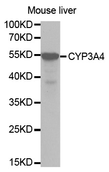 CYP3A4 / Cytochrome P450 3A4 Antibody - Western blot analysis of extracts of Mouse liver, using CYP3A4 antibody.